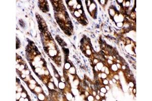 IHC-P: Caspase-6 antibody testing of rat intestine tissue (Caspase 6 anticorps  (AA 7-27))