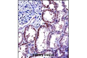 IL6 Antibody (Center) ((ABIN656406 and ABIN2845700))immunohistochemistry analysis in formalin fixed and paraffin embedded human kidney tissue followed by peroxidase conjugation of the secondary antibody and DAB staining. (IL-6 anticorps  (AA 27-55))