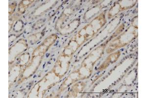 Immunoperoxidase of monoclonal antibody to PDLIM1 on formalin-fixed paraffin-embedded human kidney.
