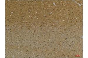 Immunohistochemistry (IHC) analysis of paraffin-embedded Rat Brain Tissue using KCNK9 (TASK-3) Rabbit Polyclonal Antibody diluted at 1:200. (KCNK9 anticorps)
