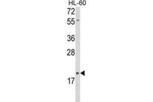 Western Blotting (WB) image for anti-delta-Like 2 Homolog (DLK2) antibody (ABIN3004005)