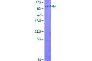 Image no. 1 for SLU7 Splicing Factor Homolog (SLU7) (AA 1-586) protein (GST tag) (ABIN1320579)