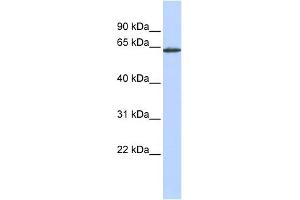 WB Suggested Anti-ANTXR1 Antibody Titration:  0. (ANTXR1 anticorps  (Middle Region))
