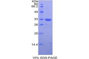SDS-PAGE analysis of Human KIR2DS4 Protein. (KIR2DS4 Protéine)
