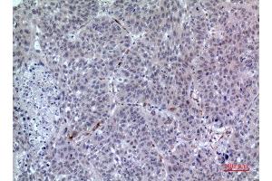 Immunohistochemistry (IHC) analysis of paraffin-embedded Human Lung, antibody was diluted at 1:100.
