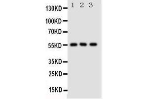 Western Blotting (WB) image for anti-Solute Carrier Family 2 (Facilitated Glucose/fructose Transporter), Member 5 (SLC2A5) (AA 232-251), (Middle Region) antibody (ABIN3044131) (SLC2A5 anticorps  (Middle Region))