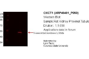 Western Blotting (WB) image for anti-3-Oxoacid CoA Transferase 1 (OXCT1) (Middle Region) antibody (ABIN2783388) (OXCT1 anticorps  (Middle Region))