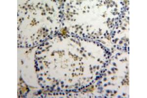 IHC-P analysis of Testis tissue, with DAB staining. (AATF anticorps  (AA 240-438))