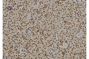 ABIN6269101 at 1/100 staining Rat kidney tissue by IHC-P. (Retinoblastoma 1 anticorps  (C-Term))