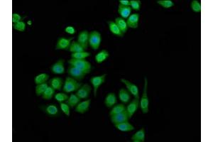 Immunofluorescence staining of PC-3 cells with ABIN7144251 at 1:100, counter-stained with DAPI.