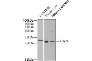 Western blot analysis of extracts of various cell lines, using PDYN antibody (ABIN6129606, ABIN6145418, ABIN6145419 and ABIN6221524) at 1:1000 dilution. (PDYN anticorps  (AA 21-254))