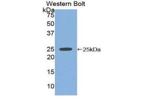 Western Blotting (WB) image for anti-Sprouty Homolog 2 (SPRY2) (AA 116-304) antibody (ABIN1860621) (SPRY2 anticorps  (AA 116-304))