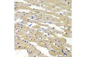 Immunohistochemistry (IHC) image for anti-BCL2-Antagonist/killer 1 (BAK1) (AA 62-112) antibody (ABIN3020677)
