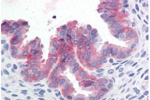 Human Uterus (formalin-fixed, paraffin-embedded) stained with c-Met antibody ABIN351534 at 10 ug/ml followed by biotinylated anti-mouse IgG secondary antibody ABIN481714, alkaline phosphatase-streptavidin and chromogen. (c-MET anticorps  (Cytoplasmic Domain))
