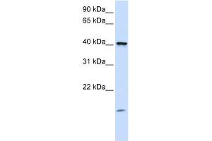 WB Suggested Anti-TMEM79 Antibody Titration:  0. (TMEM79 anticorps  (C-Term))