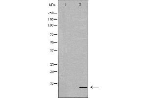 Western blot analysis of extracts of Jurkat, using MIF antibody. (MIF anticorps  (C-Term))