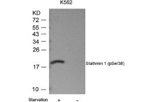 Western blot analysis of extracts from K562 cells untreated or treated with starvation using Stathmin 1(Phospho-Ser38) Antibody. (Stathmin 1 anticorps  (pSer38))