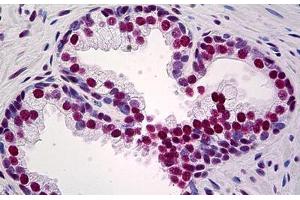 Human Prostate: Formalin-Fixed, Paraffin-Embedded (FFPE)