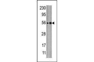 NMD3 anticorps  (C-Term)