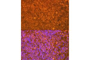Immunofluorescence analysis of human spleen cells using EBI3 Rabbit mAb (ABIN7268011) at dilution of 1:100 (40x lens). (EBI3 anticorps)