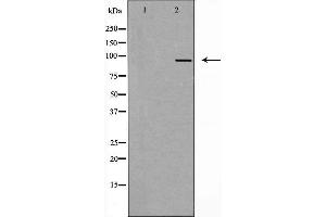 Western blot analysis of extracts from COS7 cells, using AAK1 antibody. (AAK1 anticorps  (Internal Region))