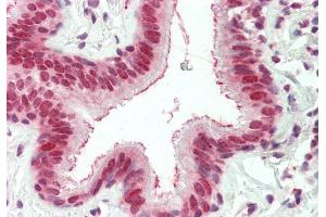 Rabbit Anti-EXOSC10 antibody  Formalin Fixed Paraffin Embedded Tissue: Human Lung, Respiratory Epithelium Primary antibody Concentration: 1:100 Secondary Antibody: Donkey anti-Rabbit-Cy3 Secondary Antibody Concentration: 1:200 Magnification: 20x Exposure Time: 0.