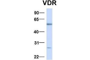 Host:  Rabbit  Target Name:  VDR  Sample Type:  Human Fetal Liver  Antibody Dilution:  1. (Vitamin D Receptor anticorps  (N-Term))