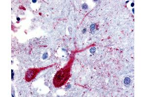 Anti-SLC5A9 antibody IHC of human brain, cortex.