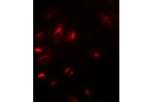 Immunofluorescent analysis of NELF-E staining in U2OS cells. (RDBP anticorps)