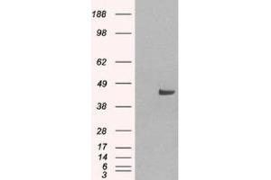 Western Blotting (WB) image for anti-Sorting Nexin 16 (SNX16) (N-Term) antibody (ABIN2466293) (SNX16 anticorps  (N-Term))