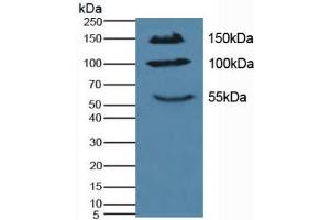 Figure. (IL17RA anticorps  (AA 590-848))
