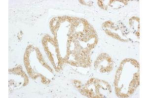 Immunohistochemistry (IHC) image for anti-PDZ Binding Kinase (PBK) (AA 200-250) antibody (ABIN7454549)