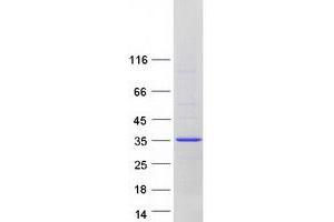 Validation with Western Blot