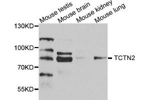 Western blot analysis of extract of various cells, using TCTN2 antibody. (TCTN2 anticorps)