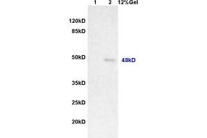 Lane 1: rat brain lysates Lane 2: human colon carcinoma lysates probed with Anti MAGEA11 Polyclonal Antibody, Unconjugated (ABIN721285) at 1:200 in 4 °C.