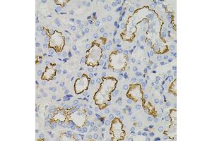 Immunohistochemistry of paraffin-embedded mouse kidney using STX1A antibody (ABIN5995405) (40x lens).