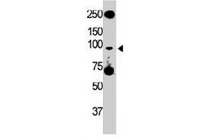 The Tlr5 polyclonal antibody  is used in Western blot to detect TLR5 in HL-60 cell lysate. (TLR5 anticorps  (C-Term))