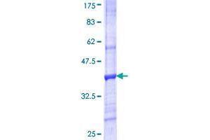 Image no. 1 for Vanin 3 (VNN3) (AA 175-274) protein (GST tag) (ABIN1325034)