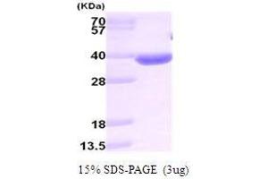 Figure annotation denotes ug of protein loaded and % gel used.