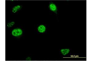 Immunofluorescence of monoclonal antibody to CDC20B on HeLa cell. (CDC20B anticorps  (AA 416-515))