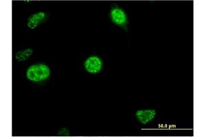 Immunofluorescence of monoclonal antibody to CDC20B on HeLa cell.