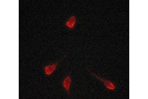 ABIN6269033 staining LOVO cells by ICC/IF.
