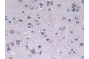 Detection of FADS2 in Human Cerebrum Tissue using Polyclonal Antibody to Fatty Acid Desaturase 2 (FADS2)