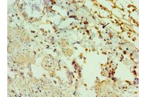 Immunohistochemistry of paraffin-embedded human epityphlon tissue using ABIN7153430 at dilution of 1:100 (GAL anticorps  (AA 20-123))
