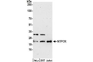 Western Blotting (WB) image for anti-Nucleoside-Triphosphatase, Cancer-Related (NTPCR) (AA 140-190) antibody (ABIN7449242)