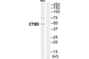Western blot analysis of extracts from HeLa cells, using CTSD antibody. (Cathepsin D anticorps  (Internal Region))