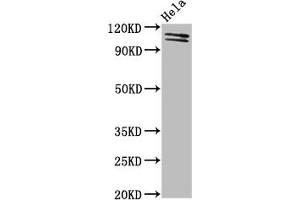 Western Blot Positive WB detected in: Hela whole cell lysate All lanes: UBA1 antibody at 2 μg/mL Secondary Goat polyclonal to rabbit IgG at 1/50000 dilution Predicted band size: 118, 114 kDa Observed band size: 118, 114 kDa (UBA1 anticorps  (AA 730-881))