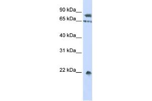 WB Suggested Anti-SENP1 Antibody Titration: 0. (SENP1 anticorps  (Middle Region))