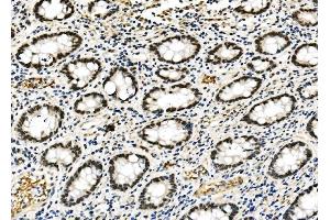 IHC analysis of RCC1 using anti-RCC1 antibody (ABIN7600024). (RCC1 anticorps  (AA 14-421))