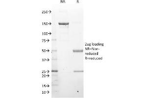 Purified LMO2 Mouse Monoclonal Antibody (LMO2/1971).